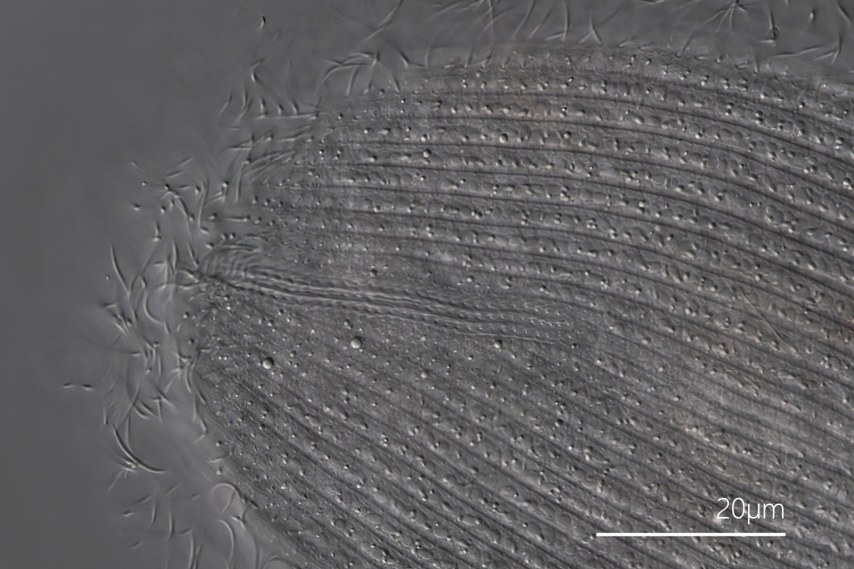 Holophrya discolor Dorsalbürste